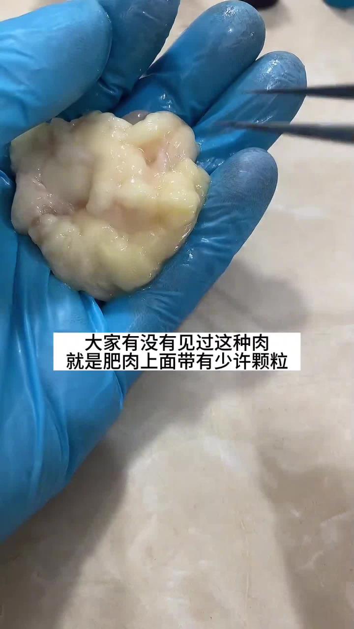 少吃肥肉尽量避免淋巴肉