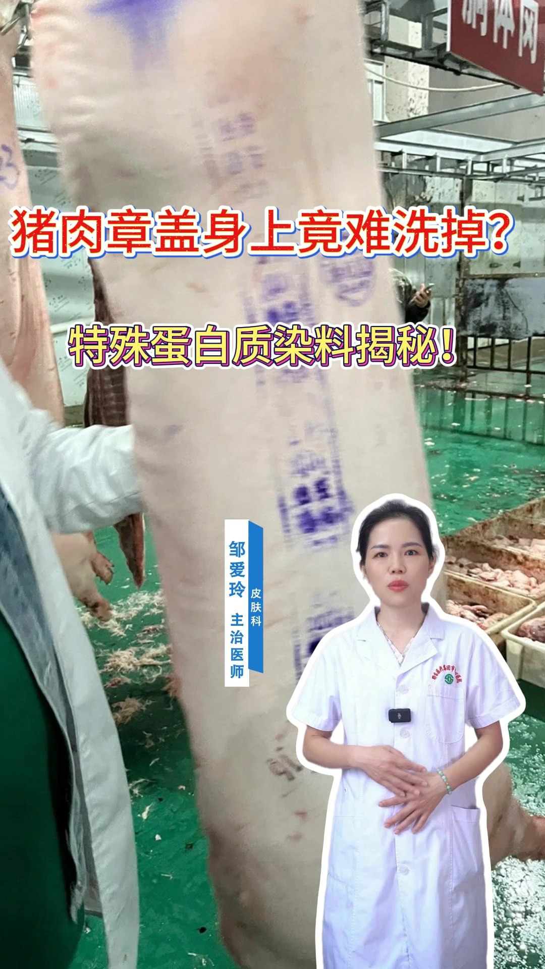 猪肉章盖人身上能洗掉吗?