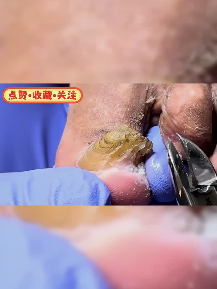 脚趾头上长出一座山,修剪得恰到好处～