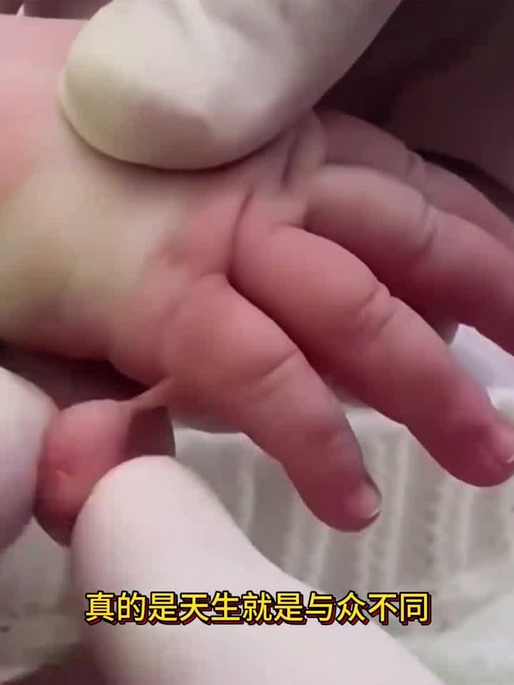 手上的肉疙瘩,到底该怎么办呢?
