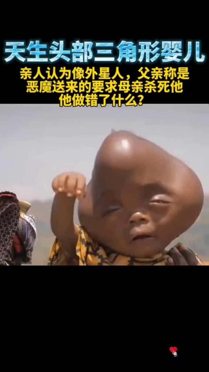 卢旺达一婴儿神似外星人,天生头部呈三角形,父亲要求母亲杀死他:这是恶魔送来的!