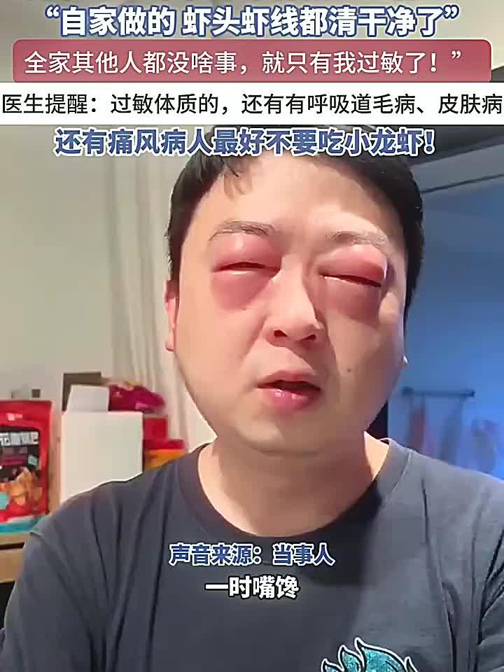男子吃小龙虾后全身浮肿,模样大变似卡通蛙!