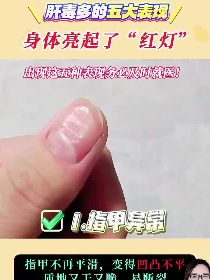 警惕!身体三处发黑,可能是癌症信号