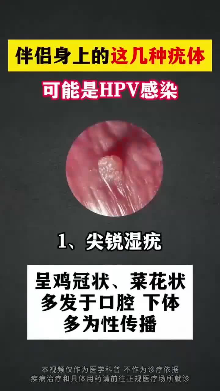 伴侣皮肤疣,警惕HPV风险