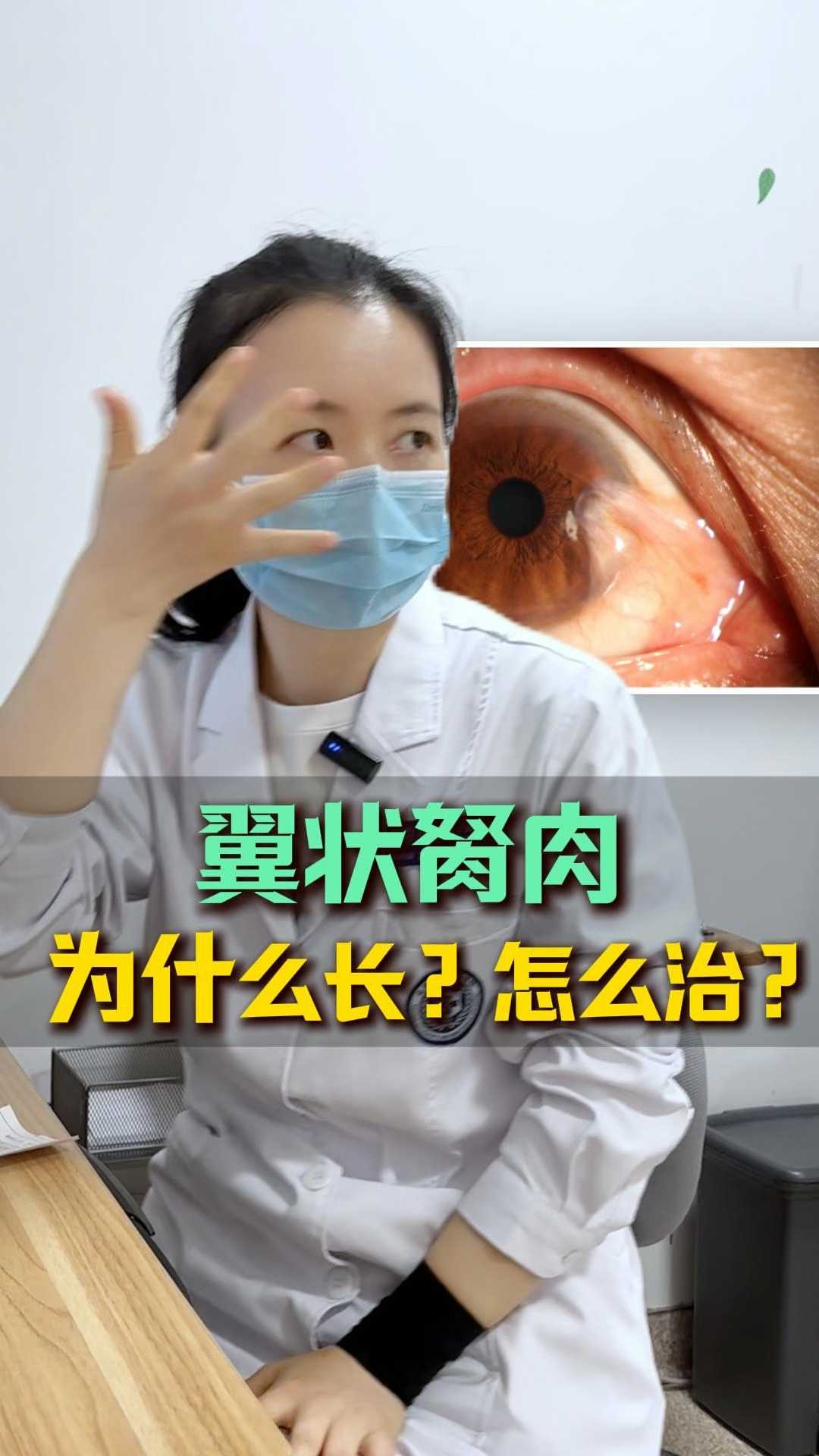 #近视防控##斜视##健康科普##翼状胬肉#