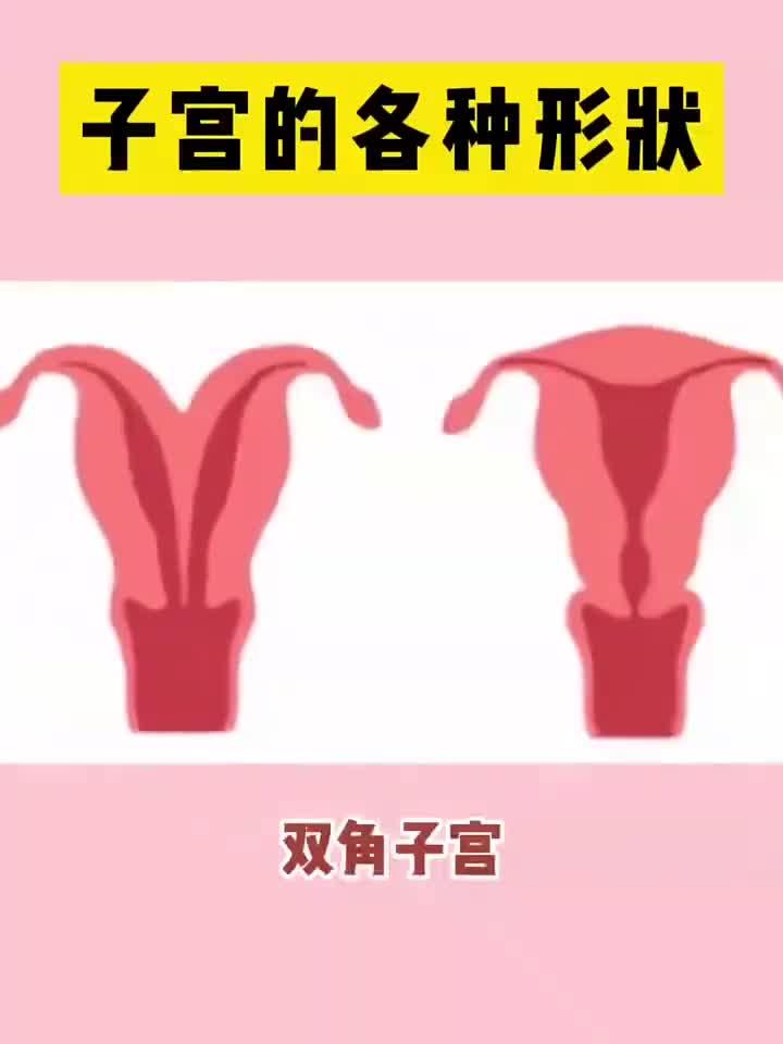 子宫的各种形状