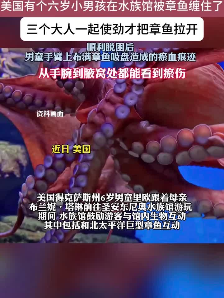 六岁男童被章鱼缠住,三个大人合力才脱身!