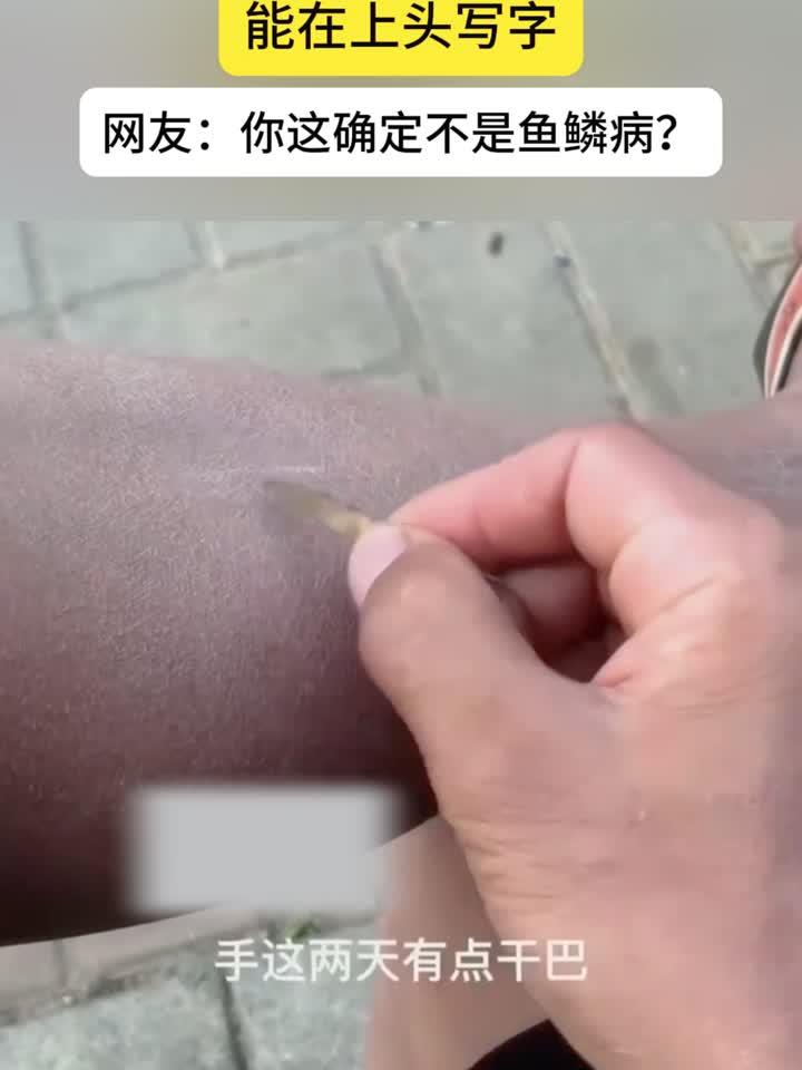 男子的皮肤有点干巴,甚至能在上面写字