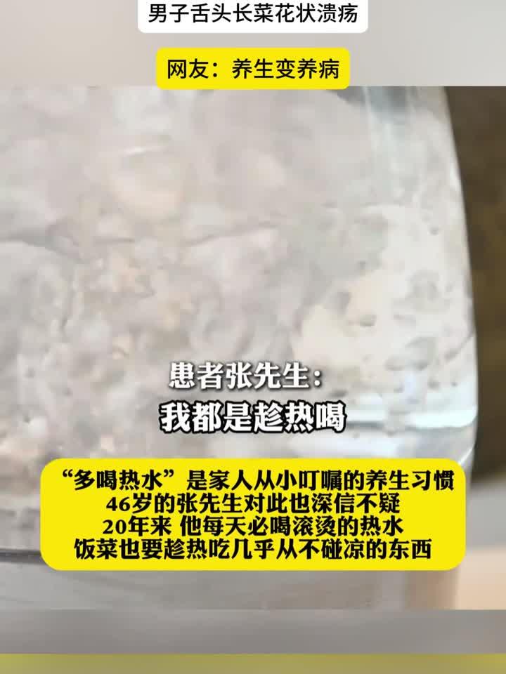 20 年喝滚烫水养生竟得舌癌，男子舌头长菜花状溃疡