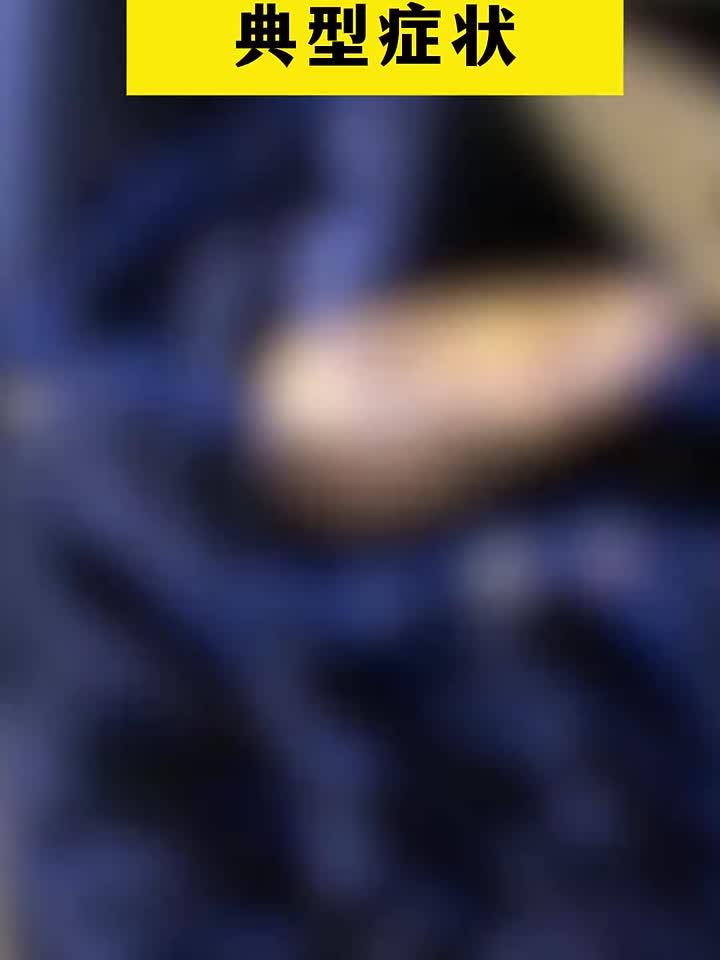15种常见癌症的典型症状