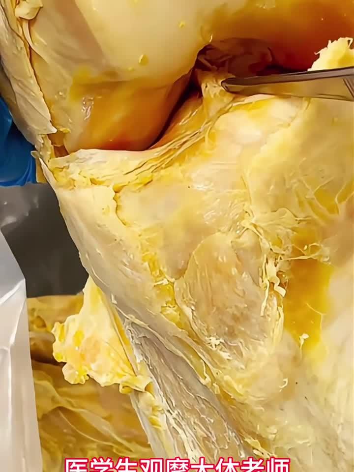 妇科检查必备:医用鸭嘴钳使用全揭秘
