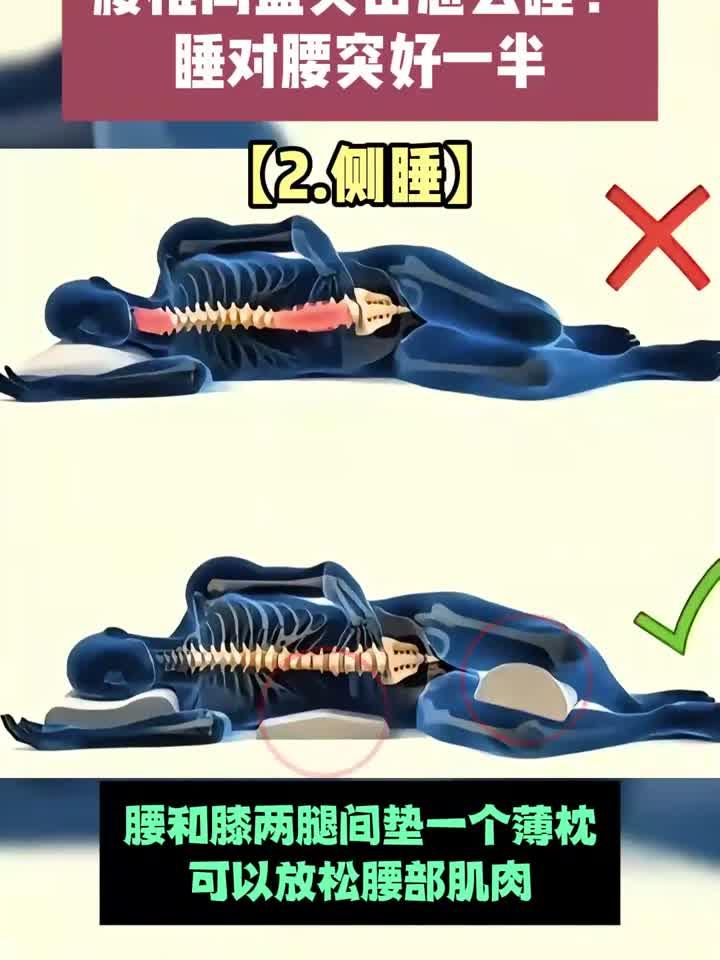 私处菜花状疣体警示录:症状识别与应对指南