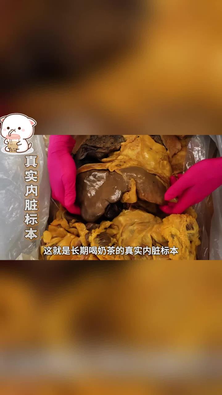 你知道长期喝奶茶对身体有哪些危害吗？