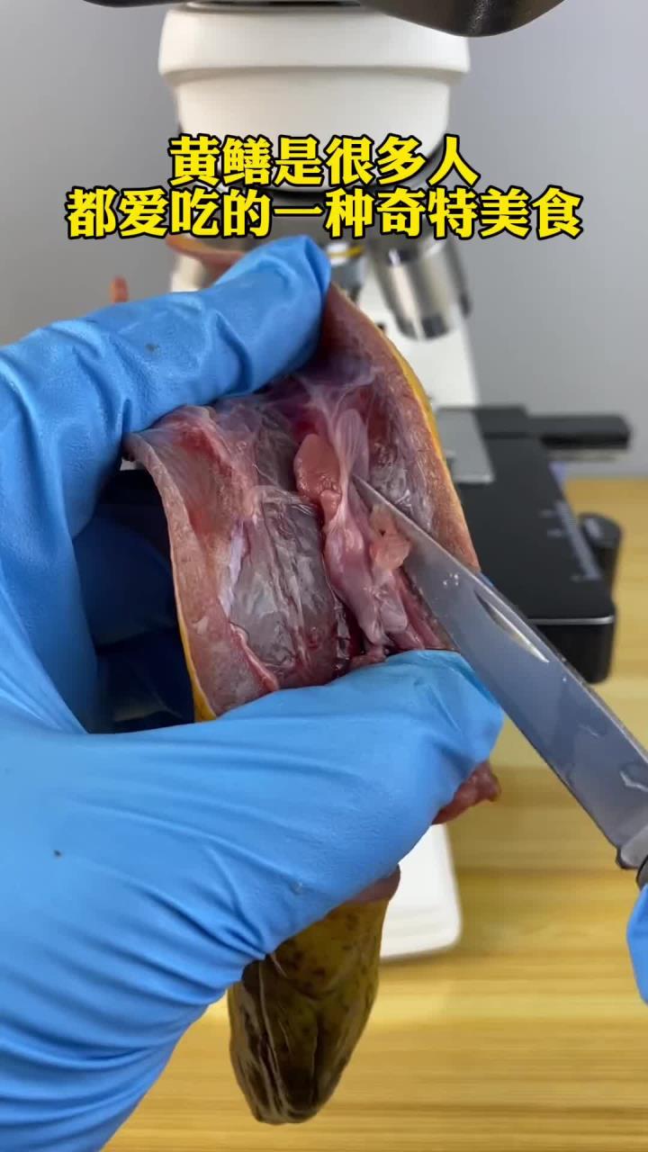 黄鳝真有寄生虫吗？(1)