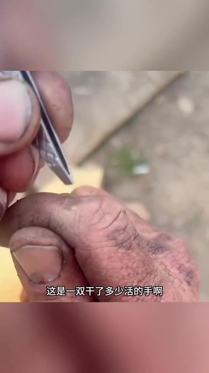 粗糙双手长肉刺,如何有效解决?让我们一起探讨!