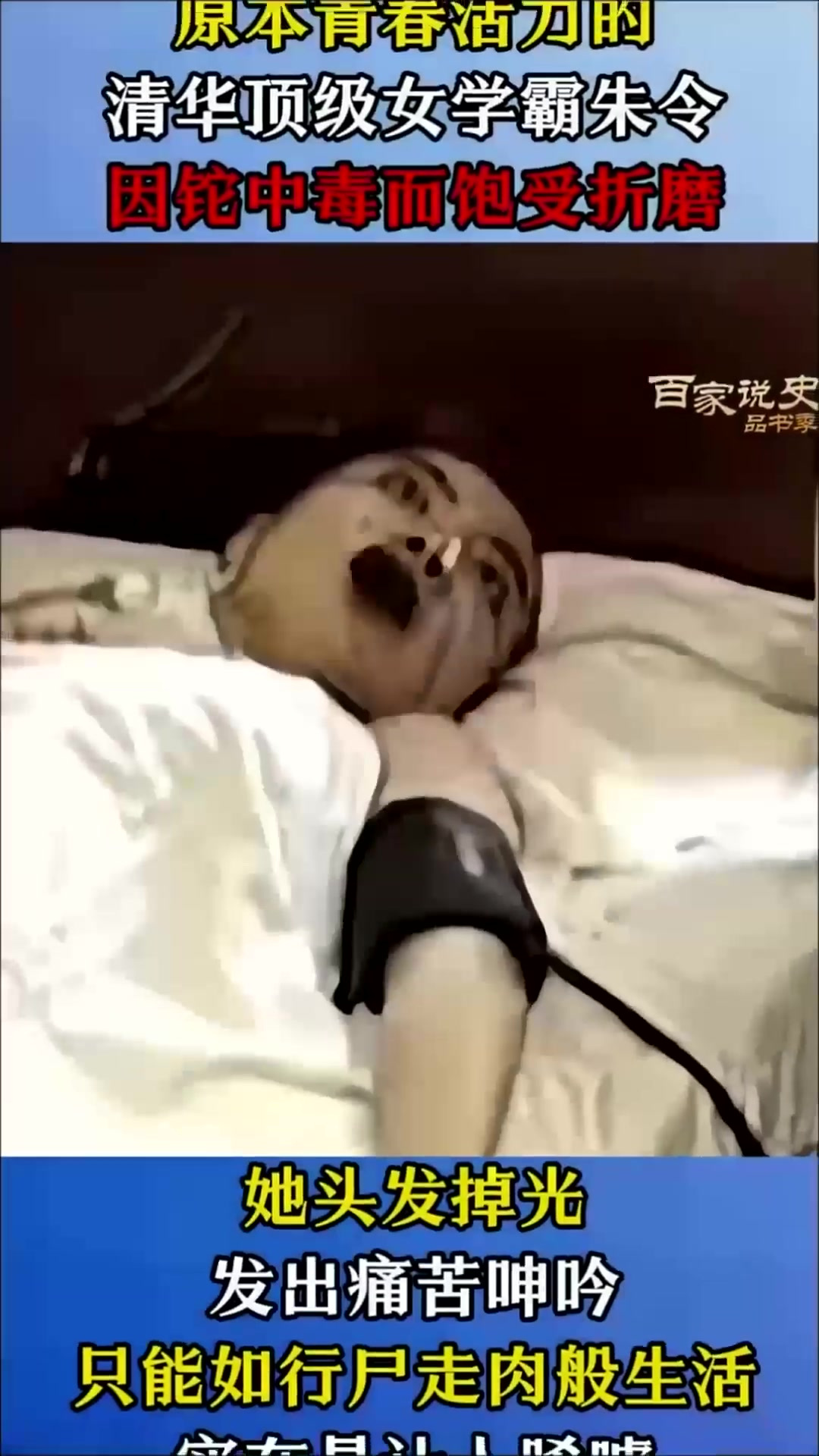 1995年清华才女真实影像：因铊中毒而饱受折磨，像行尸走肉般生活