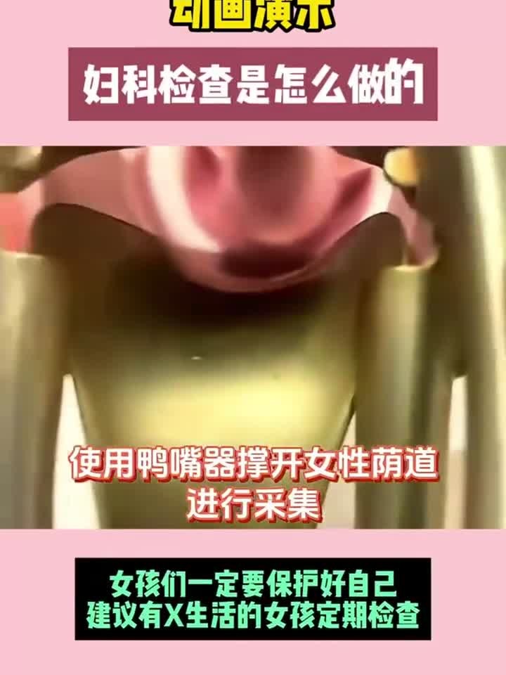 妇科检查 一镜到底