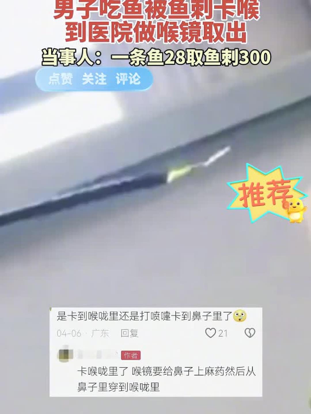男子吃鱼卡喉，医生用喉镜巧妙取出！
