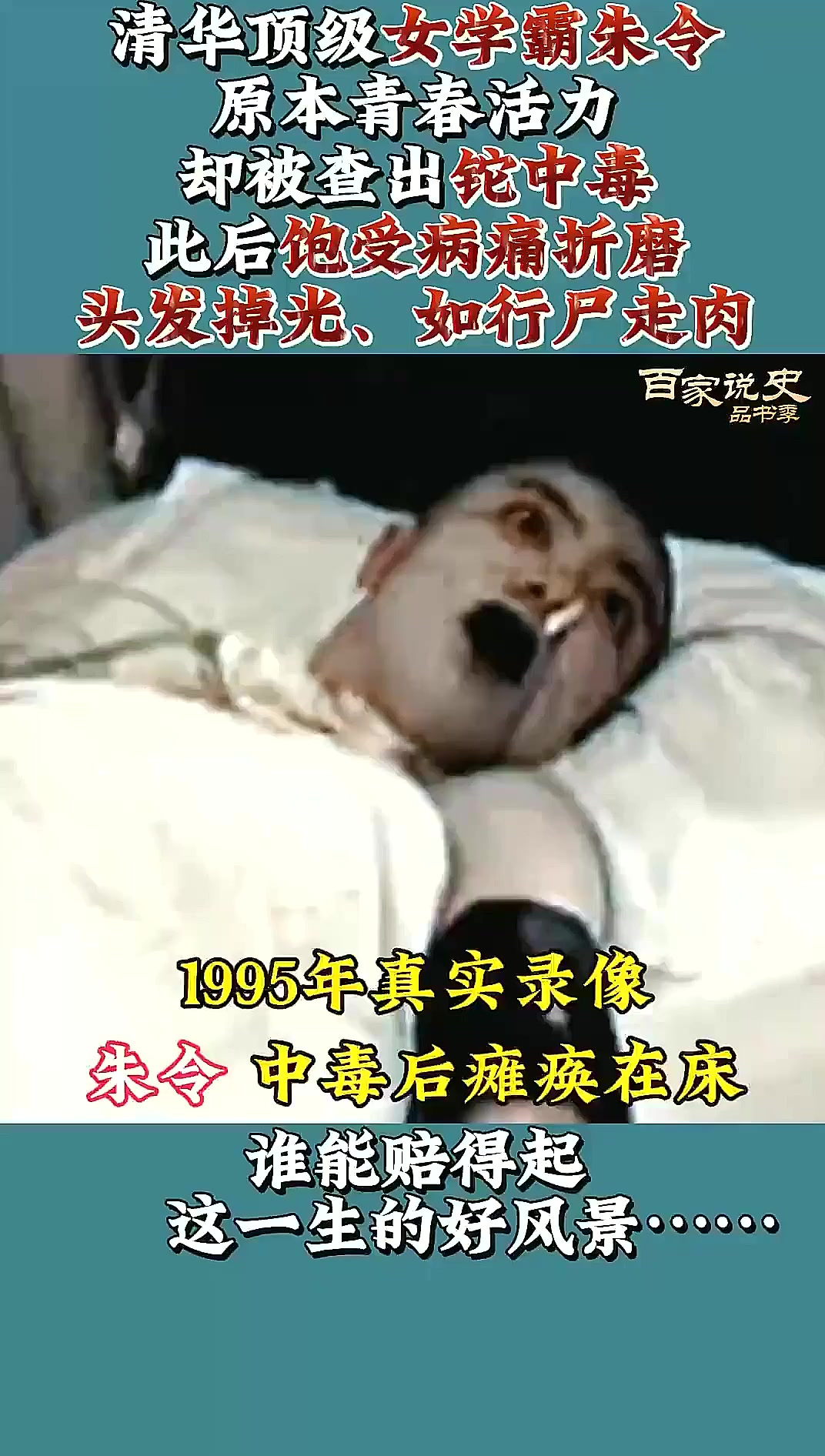 1995年真实影像:清华才女铊中毒后,瘫痪在床如“行尸走肉”,历史解析