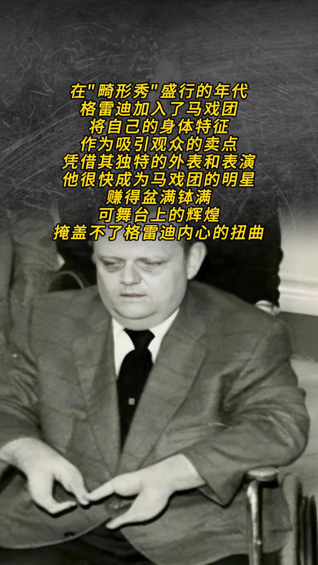 “龙虾手”男孩,手部畸形酷似虾钳,性情暴虐杀害女婿,借助“残疾”逃脱法律制裁,可怜又可恨!