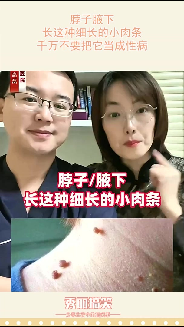脖子腋下,长这种细长的小肉条,千万不要把它当成性病!