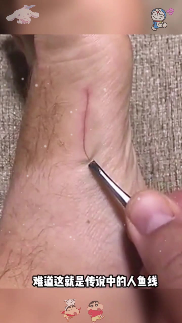  虾线还是人鱼线，看着真疼啊。