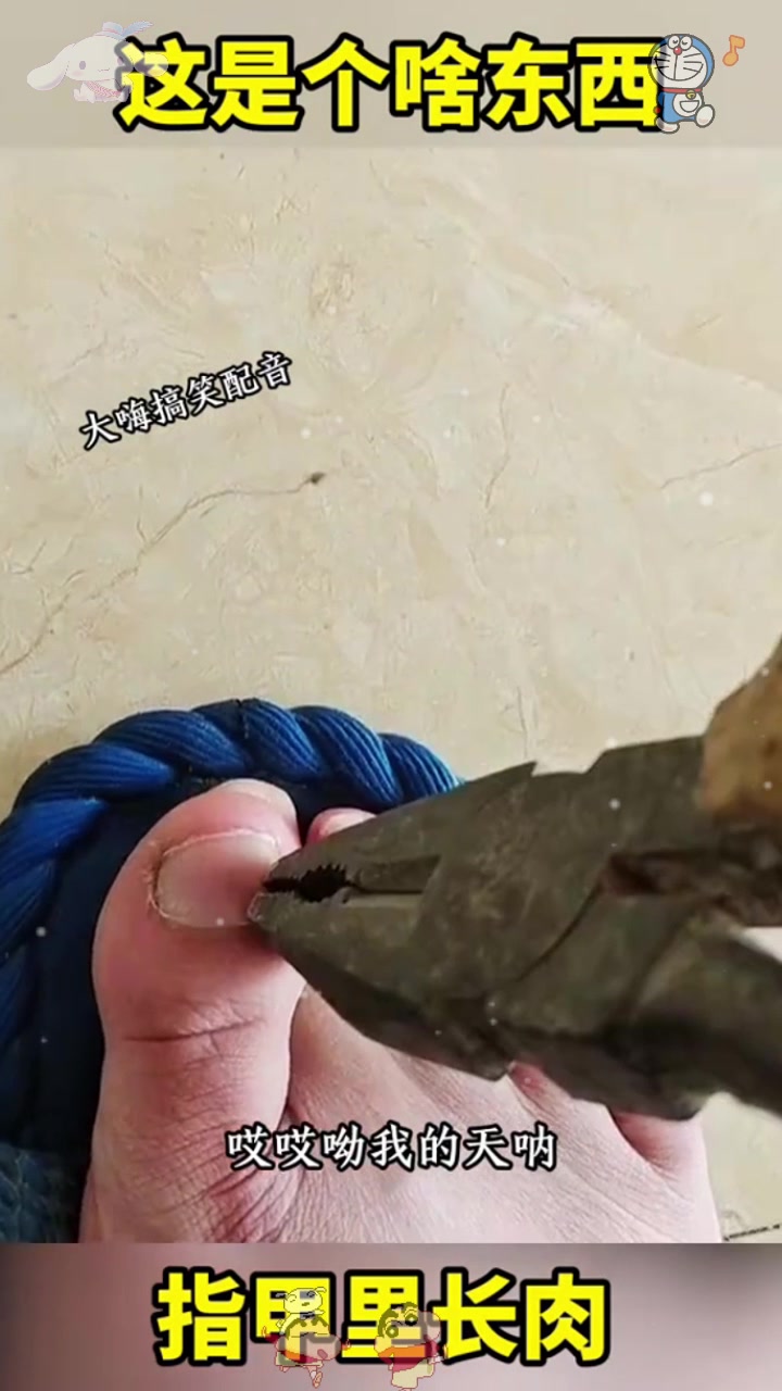  指甲里长肉，这是啥东西？