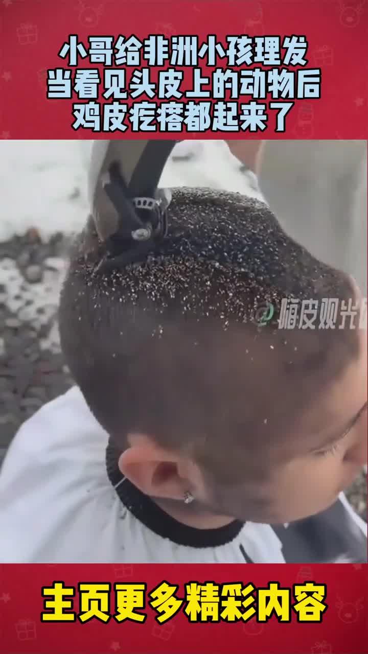 小哥给非洲小孩理发，当看见头皮上的动物后，鸡皮疙瘩都起来了！