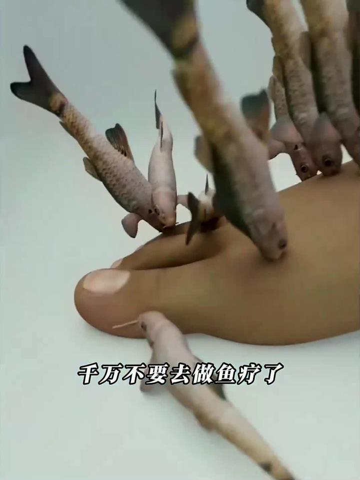 每天分享一个冷知识:你知道做鱼疗有什么可怕后果吗?
