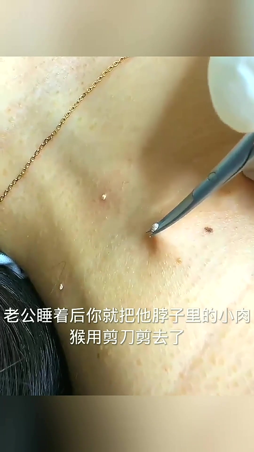 睡中丢失的肉猴,它不会再长吧!