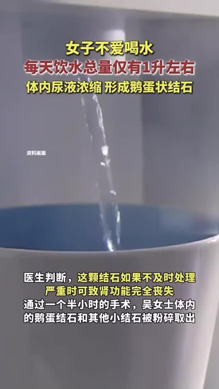 女子不爱喝水,每天饮水总量仅有1升左右,体内尿液浓缩,形成鹅