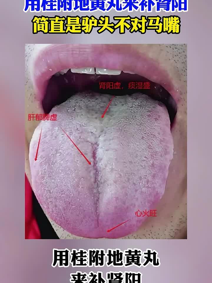 功能下降 舌苔厚腻发白用桂附地黄丸补肾阳,简直是驴头不对马嘴