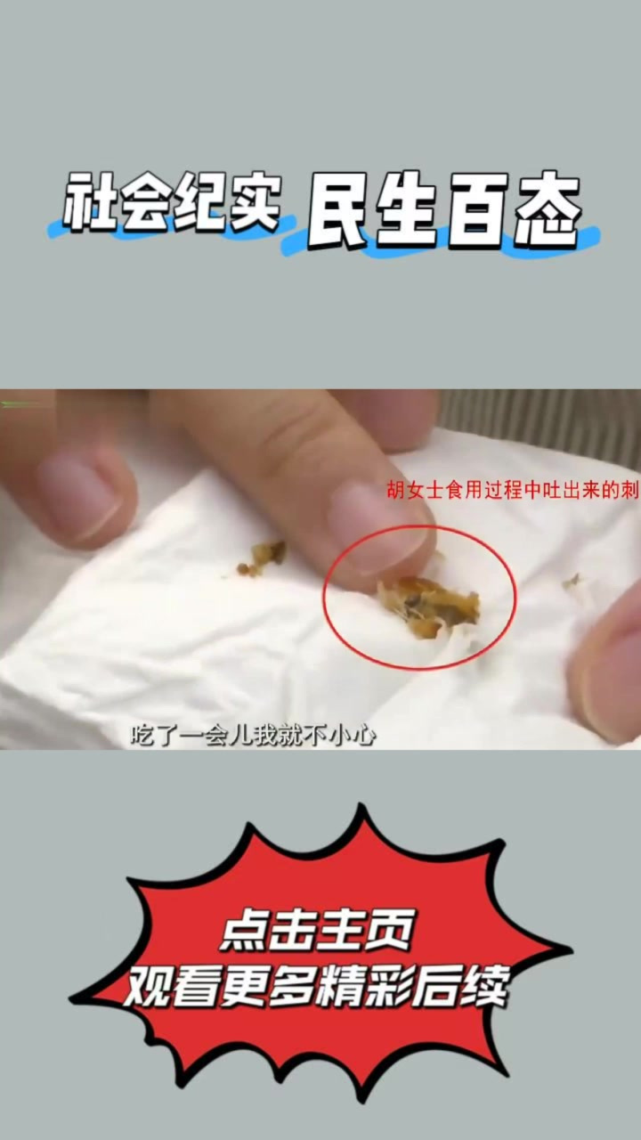 吃鳗鱼饭称被硬刺卡住喉咙,要求赔偿,女子:厨师没把鱼刺处理好②