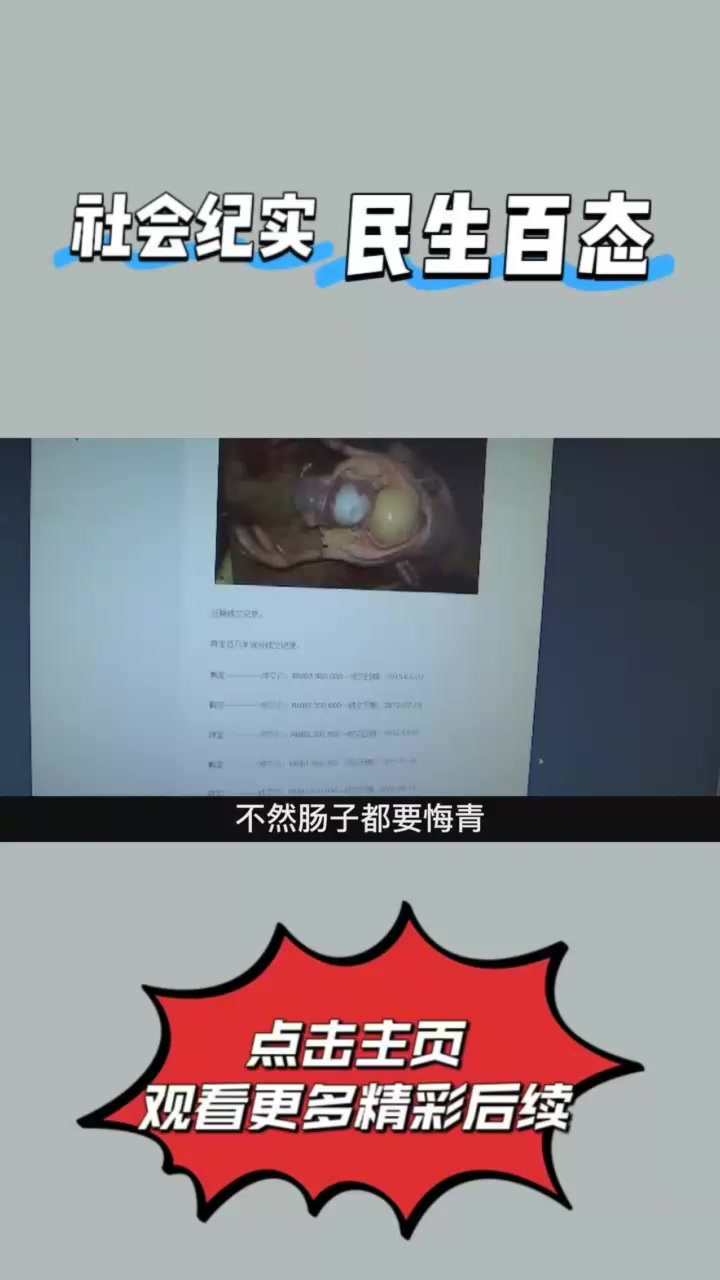 小伙捡到“天价鸭宝”！鉴定后直接激动昏倒，专家却笑出了声④