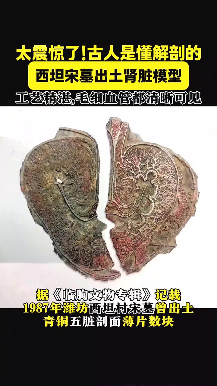 800年前出土的青铜肾脏模型,工艺精湛,毛细血管清晰可见,古人对解剖的深刻理解!
