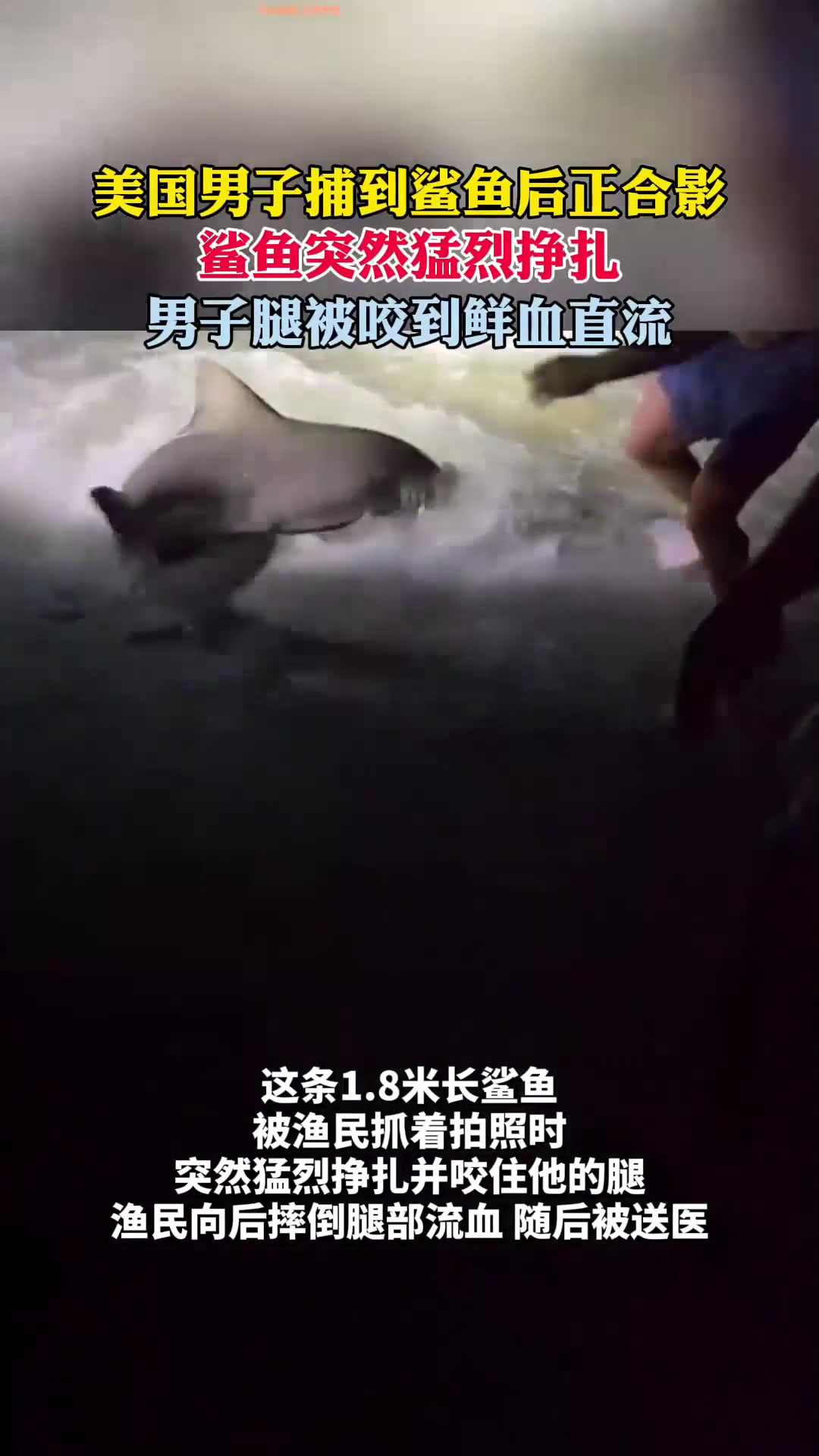 美国男子捕到鲨鱼后正合影,鲨鱼突然猛烈挣扎,男子腿被咬鲜血直