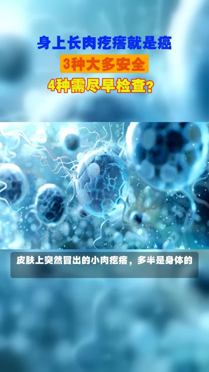 身上长肉疙瘩就是癌,3种大多安全,4种需尽早检查?