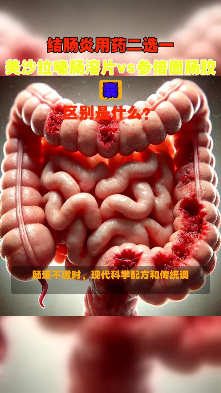 结肠炎用药二选一，美沙拉嗪肠溶片vs参倍固肠胶囊，区别是什么？