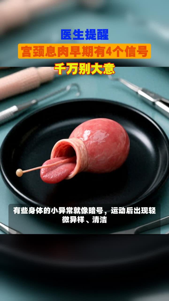 医生提醒,宫颈息肉早期有4个信号,千万别大意