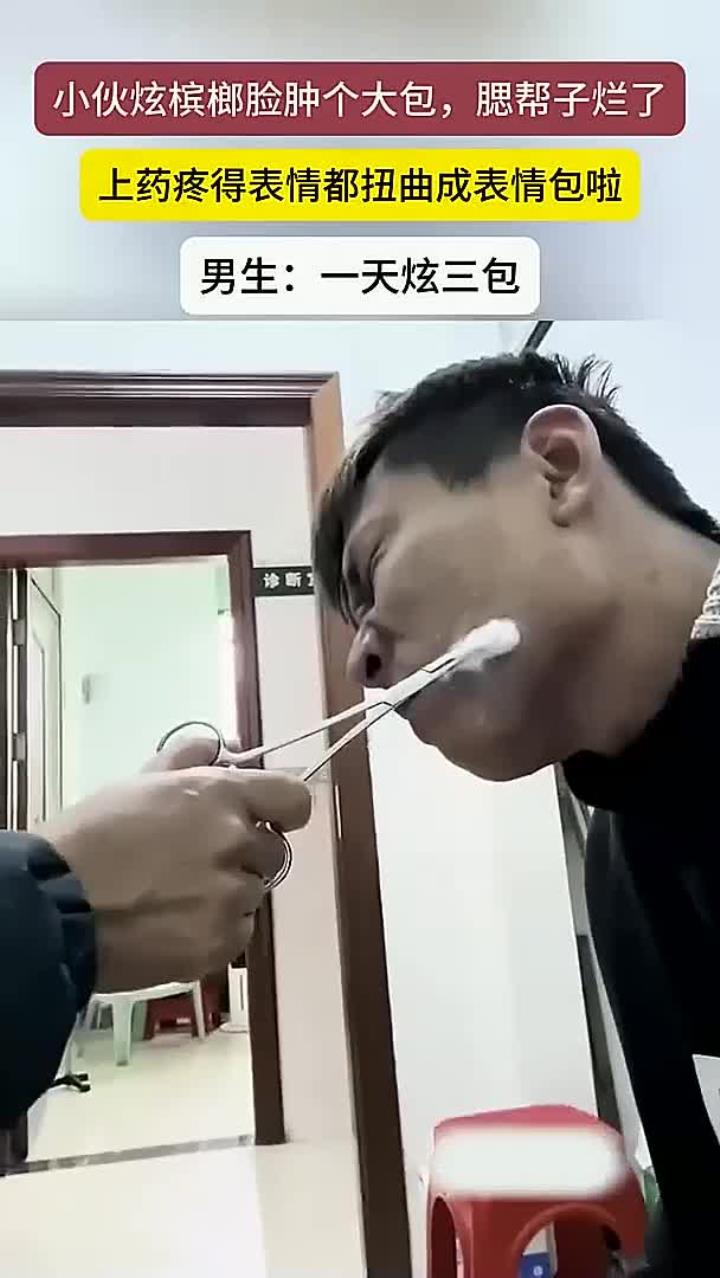 小伙吃槟榔脸上长了一个大包,腮帮子溃烂上药疼出表情包