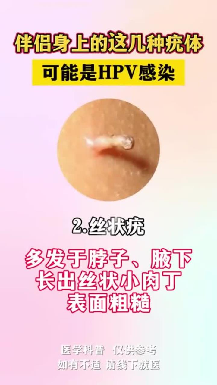 HPV感染的早期症状