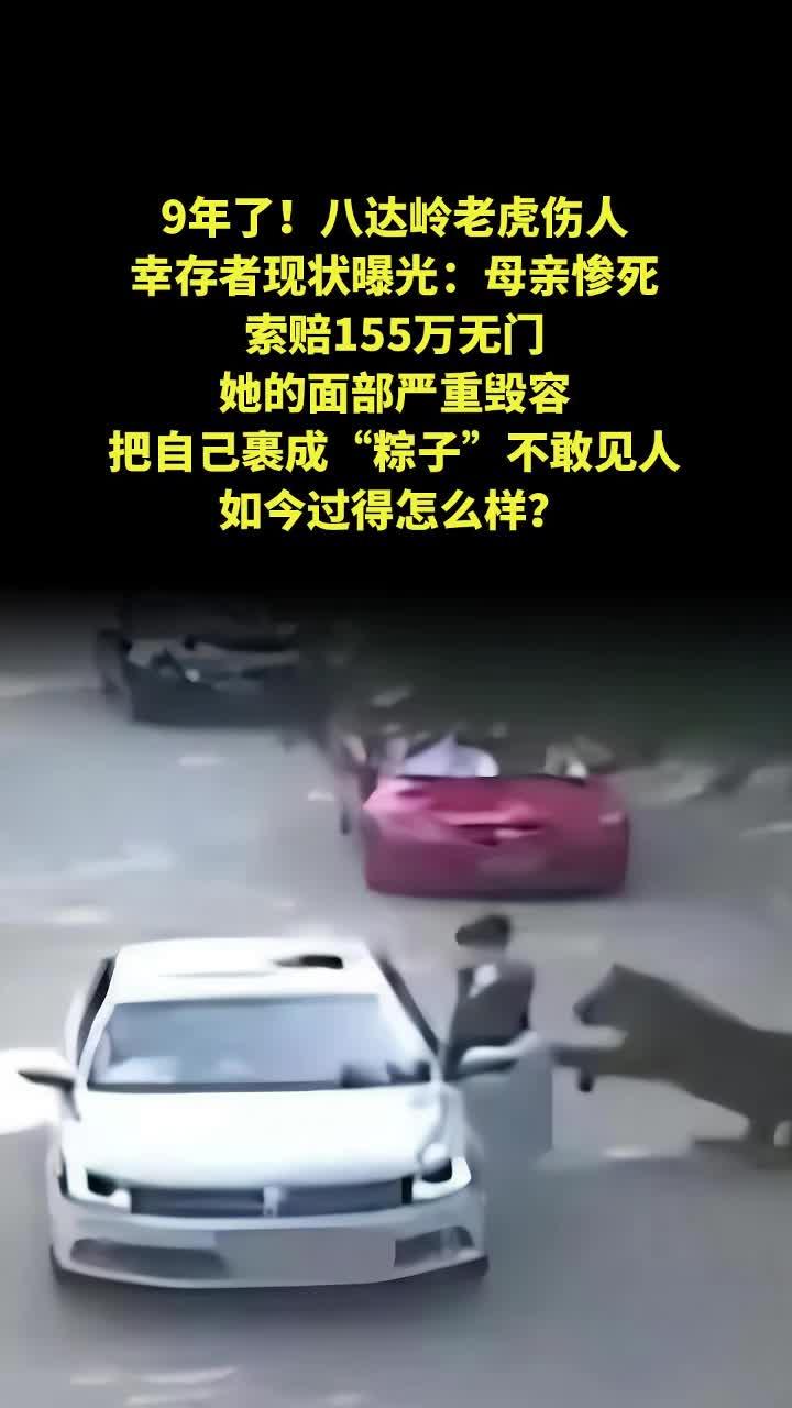 八达岭老虎伤人幸存者现状曝光