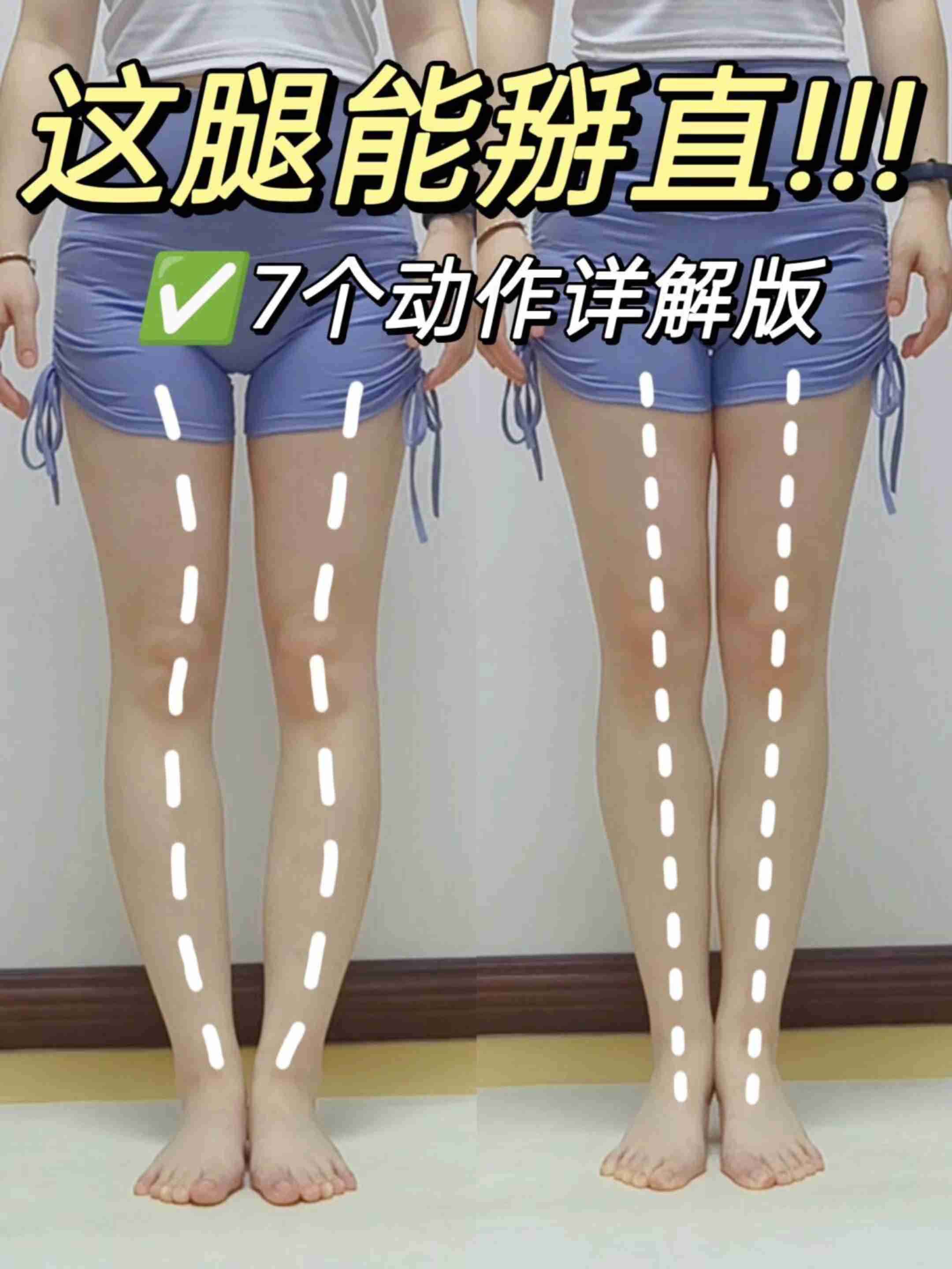 有效！7个动作串联，矫正小腿外翻肌肉腿
