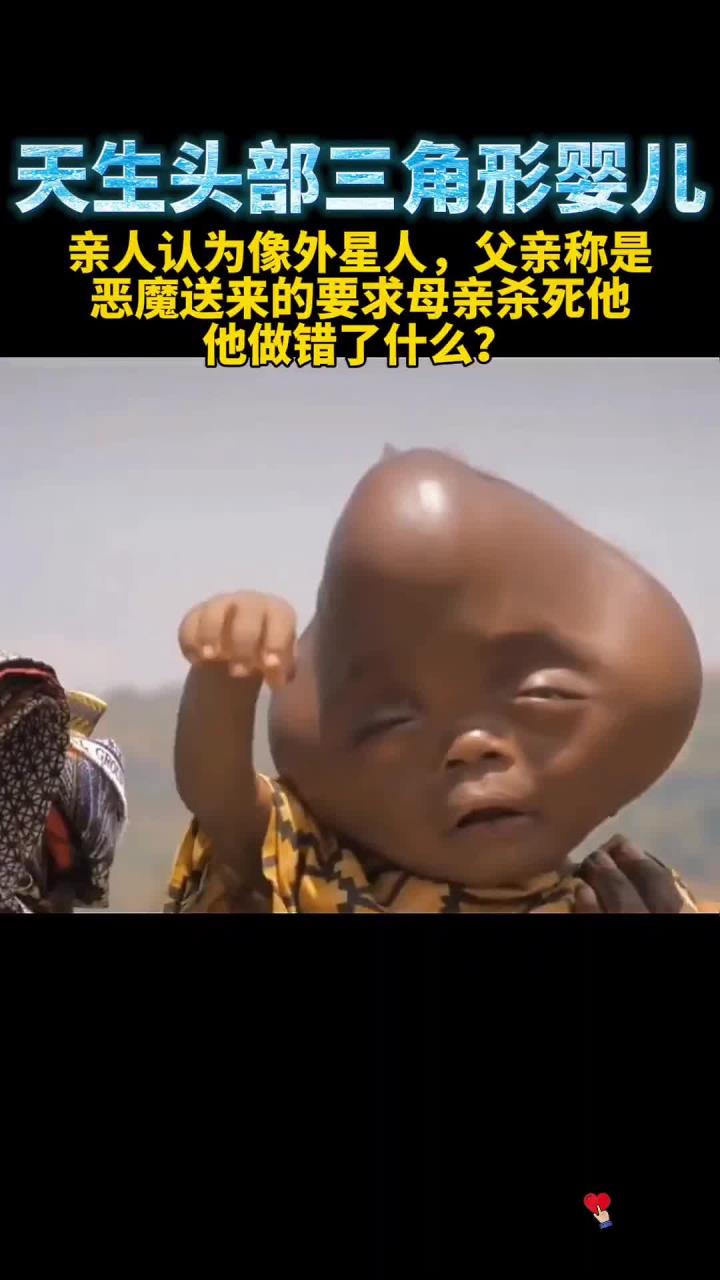 卢旺达一婴儿神似外星人,天生头部呈三角形,父亲要求母亲杀死他:这是恶魔送来的!