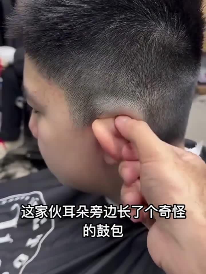 这家伙耳朵旁边长了个奇怪的鼓包