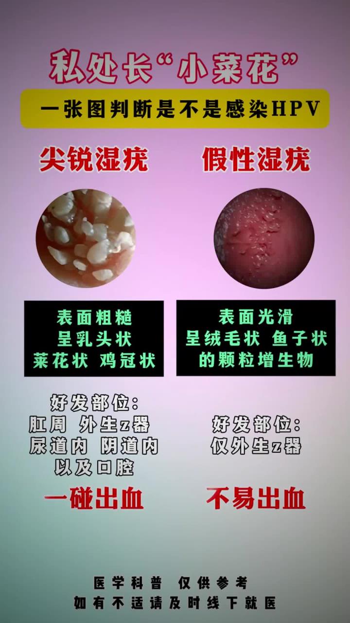 私处长“小菜花”是不是?
