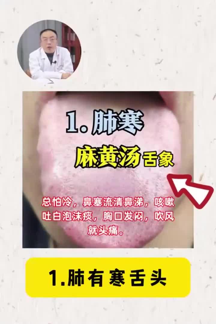 舌诊分析:五脏六腑哪有寒,一看舌头便知!