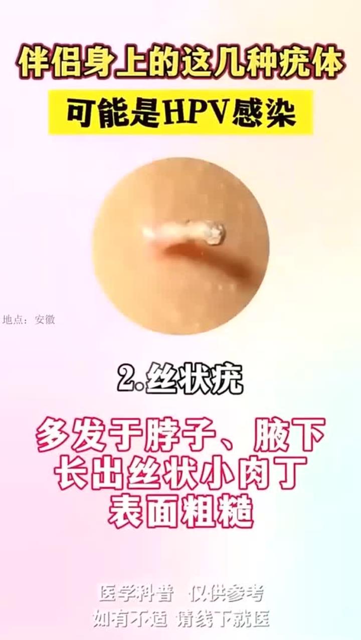 HPV感染的早期信号!