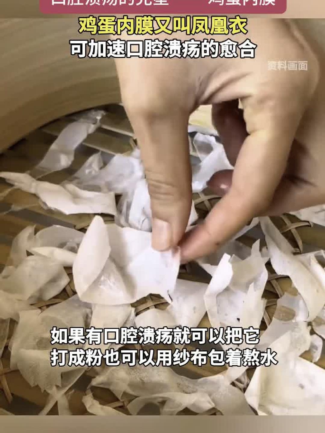 口腔溃疡的天然救星，鸡蛋内膜的神奇功效！