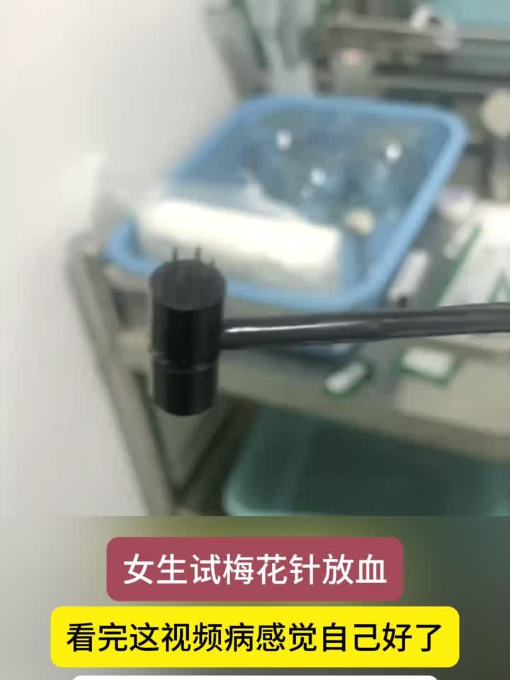 女子体验梅花针放血疗法,疗效显著引热议:网友直呼太神奇